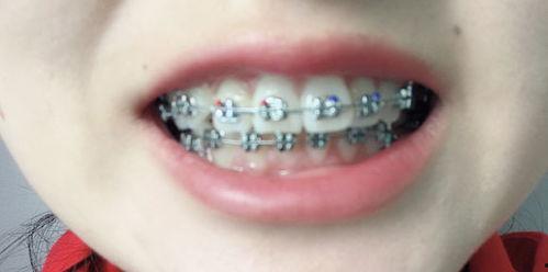 成人黑牙齿视频大全播放