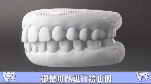 成人还能扎牙吗视频,揭秘“还能扎牙”的神奇之旅